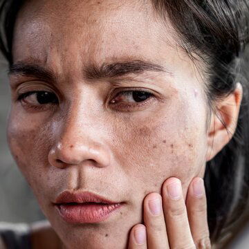 पटाखों के धुएं ने छिन ली चेहरे की रौनक, जानिए फिर से कैसे लौटेगी पुरानी वाली चमक?