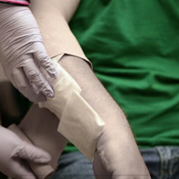 बेंगलुरु में आग से झुलसे मुर्शिदाबाद के एक और प्रवासी मजदूर की मौत, अब तक कुल 5 की गई जान